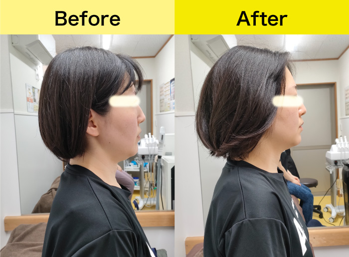 Before&After