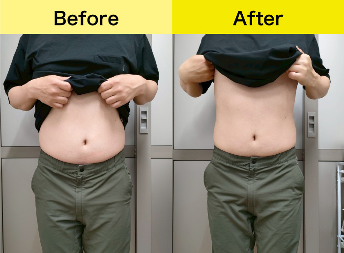 Before&After